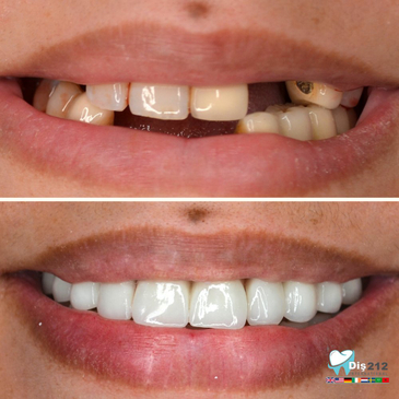 Slider image (2) Dis 212 - Dental Aesthetics Facility